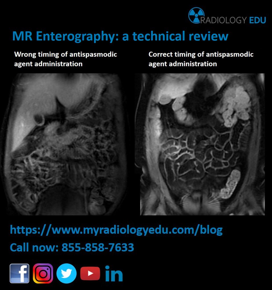 RadiologyEDU's tweet photo. New blog article about MR Enterography!
Link: https://t.co/mslSkgUVST
#radiologyedu #myradiologyedu #radiologyeducation #myradiologyeducation #radiology #myradiology #medicine #medical_imaging #MRI #MRE #enterography #Radiographer #radtech #MRI_Technologist https://t.co/y1r9Meufwc