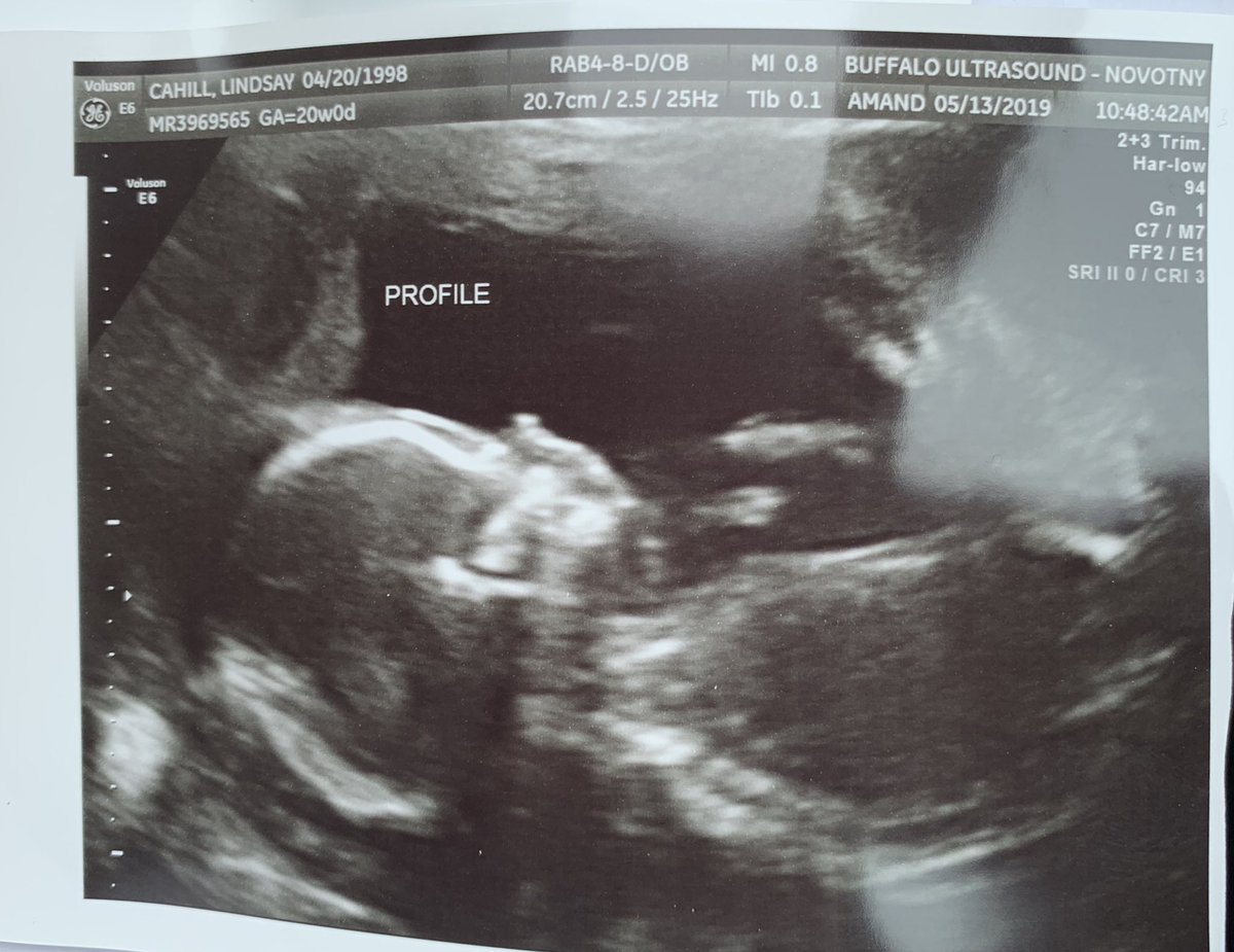lindsayyygray's tweet photo. Already such a happy little baby 🥰❤️ https://t.co/AgqzEhqSsT