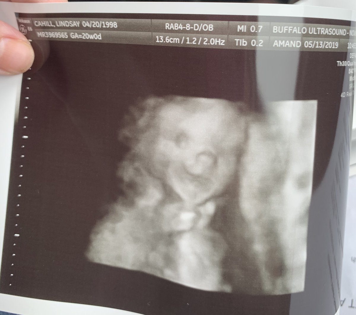 lindsayyygray's tweet photo. Already such a happy little baby 🥰❤️ https://t.co/AgqzEhqSsT