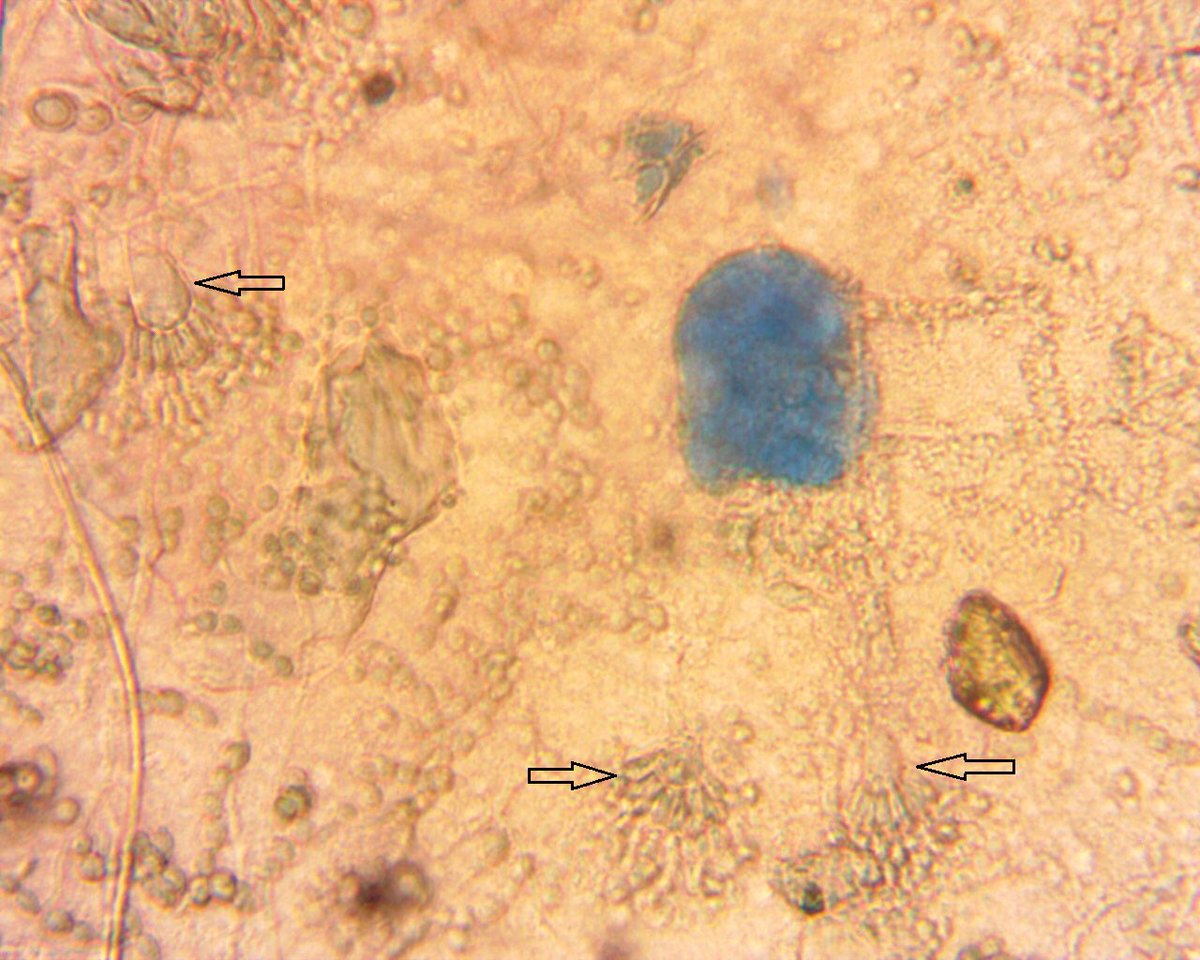 Common types of #mold include Penicillium/Aspergillus. Click here to learn more about our mold #testing services bit.ly/2DEMNJ8 🔬#Ecologics #EcologicsLab