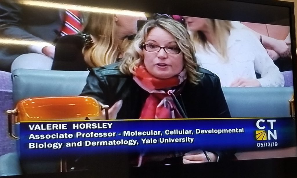 acorbe2's tweet photo. Awesome Emory BCDB and GDBBS alum/Yale scientist Dr. Valerie Horsley scientist testifying at the Public Health International Hearing on religious exemptions for vaccines- speaking truth to power about the importance of vaccinations! #EmoryGDBBS #EmoryBCDB #emoryalumni #EmoryLGS https://t.co/5l4hUORzFf