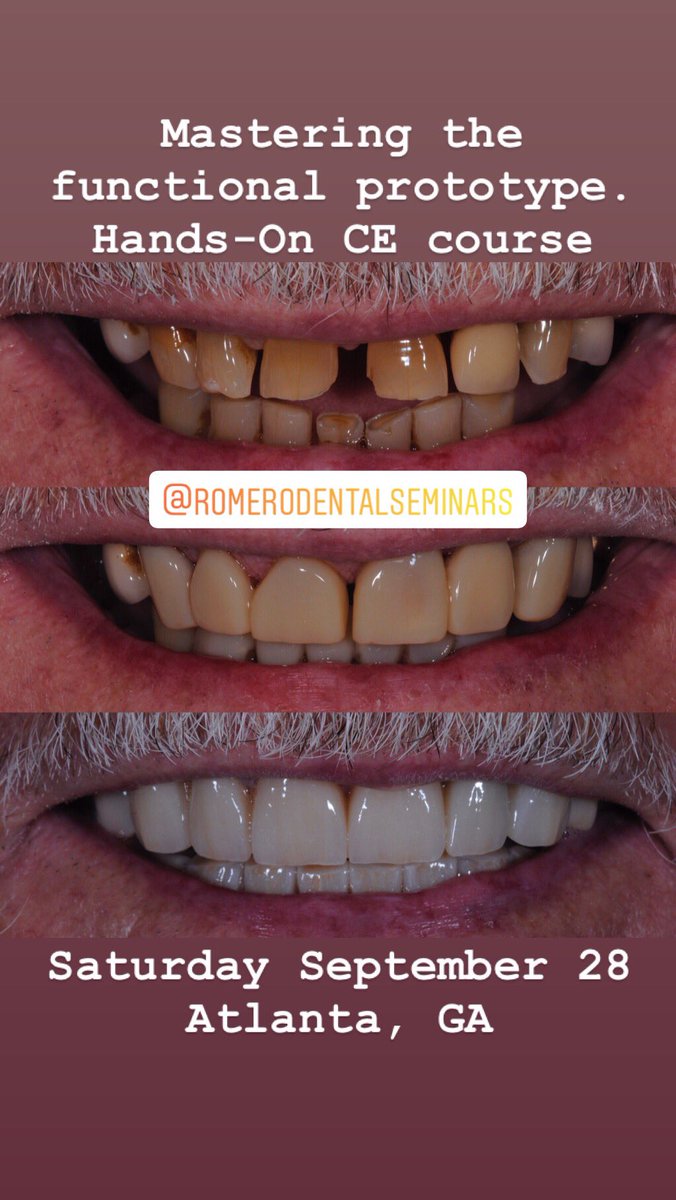 restorativeDS's tweet photo. Mark your calendar: Saturday September 28, 2019 @8:00 am in Atlanta, GA “Mastering the functional prototype for partial and full mouth rehabilitation. Hands-On” 8CE credits. (30 participants) More info? PM or email romerodentalseminars@gmail.com
.
.
.
#romerodentalseminars https://t.co/oq2bUqRlZ2