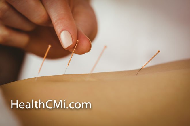 DrWangG's tweet photo. Acupuncture Alleviates GERD And Heartburn. https://t.co/BvSTjQmNQO https://t.co/vvEb2iEQmR