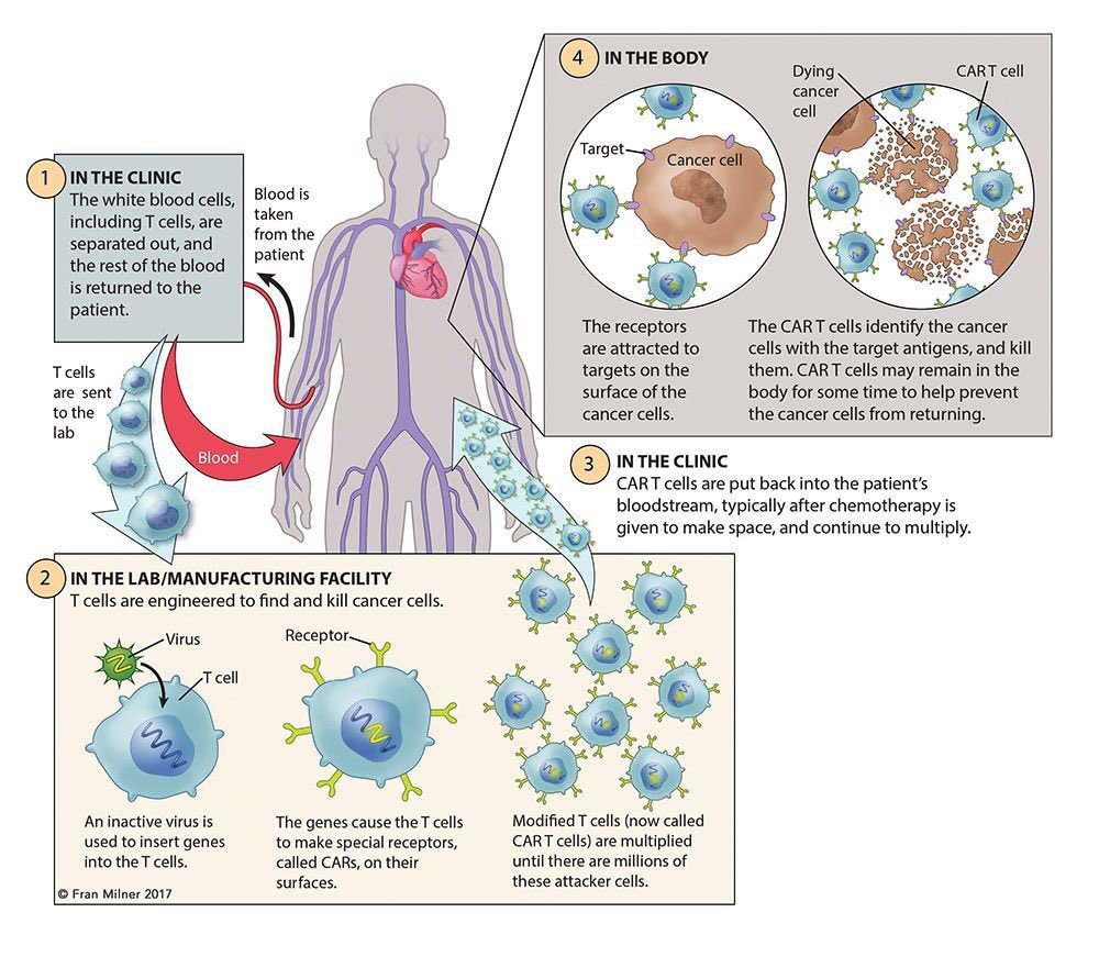 #CancerResearch #cancerbiology #cancerimmunity #cancerimmunology #Translationalmedicine #PrecisionMedicine #preventativeoncology #HaematologicalDiseases #Clinicalefficacy of #CARTcells Tx for #Bcelllymphomas: #Clinicaltrial & available Rx - journals.sagepub.com/doi/full/10.11… @SAGEClinMed