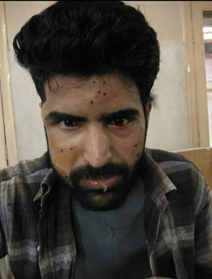 RahillAli's tweet photo. #Shame_on_JK_Police
#Shame_on_DO MANEN BEMINA
#Kashmir_police has no #humanity, where they can easily disperse the procession they #use_pellets_and_tear_gas_shells there. They use #excessive_force https://t.co/HRNJQxEbBN