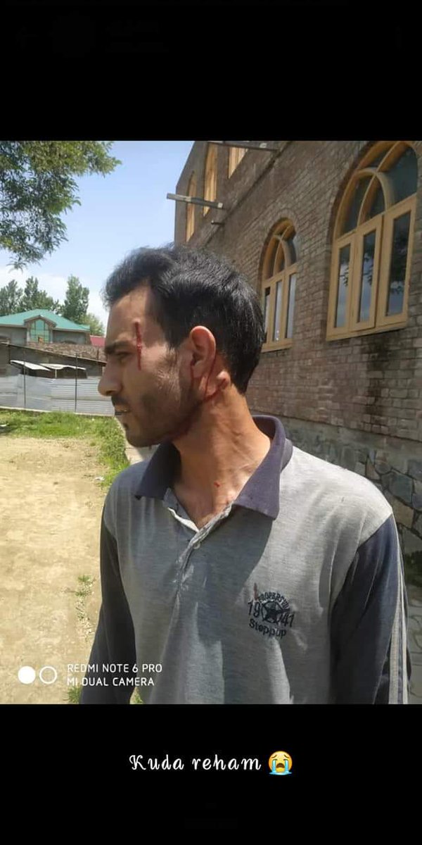 RahillAli's tweet photo. #Shame_on_JK_Police
#Shame_on_DO MANEN BEMINA
#Kashmir_police has no #humanity, where they can easily disperse the procession they #use_pellets_and_tear_gas_shells there. They use #excessive_force https://t.co/HRNJQxEbBN