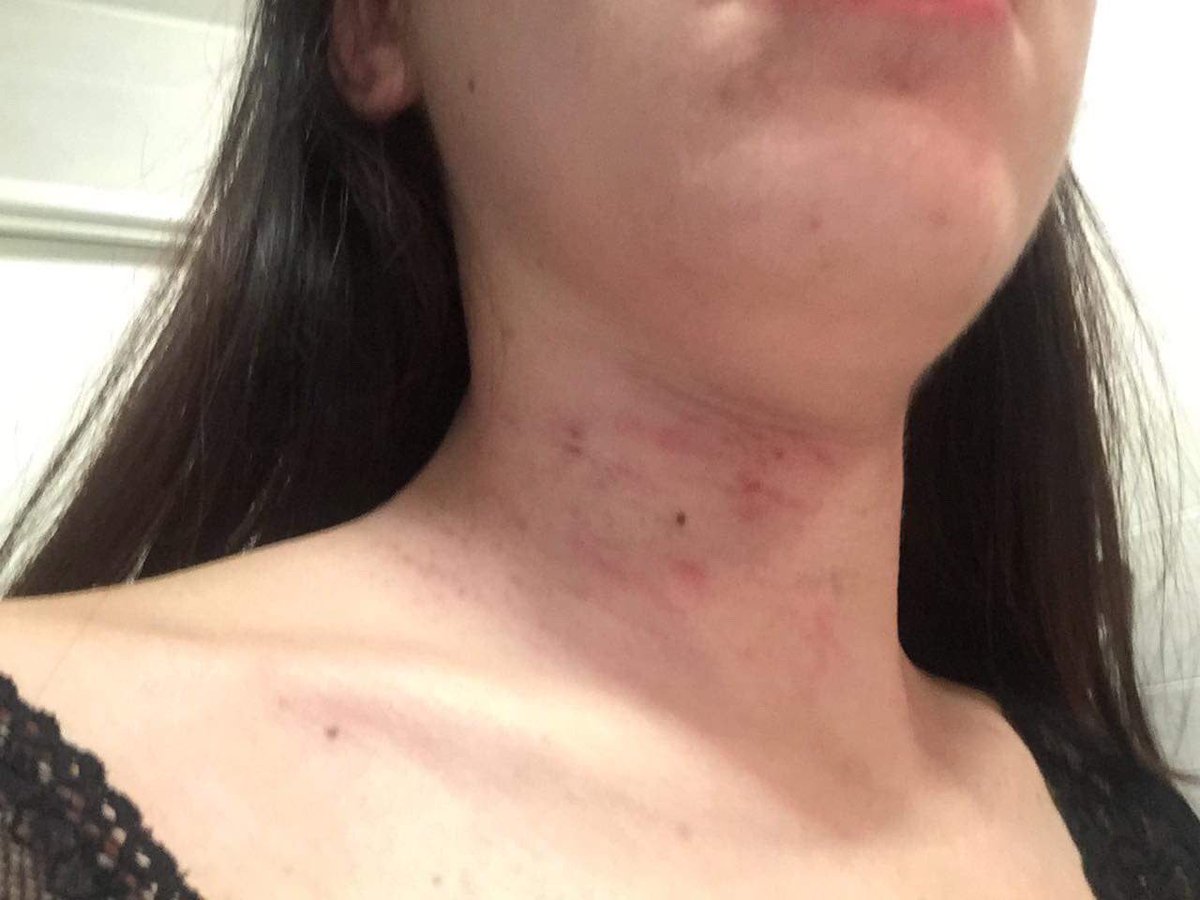 LauraetAlice's tweet image. À L’AIDE ! 
[THREAD à dérouler ]
Rescapée d'1tentative d'assassinat, en présence de ma fille de 2 ans, la justice me tourne le dos. Arrêté et placé en détention provisoire depuis avril 2018, mon tortionnaire, a fait plusieurs demandes de mise en liberté qui ont ttes été refusées.