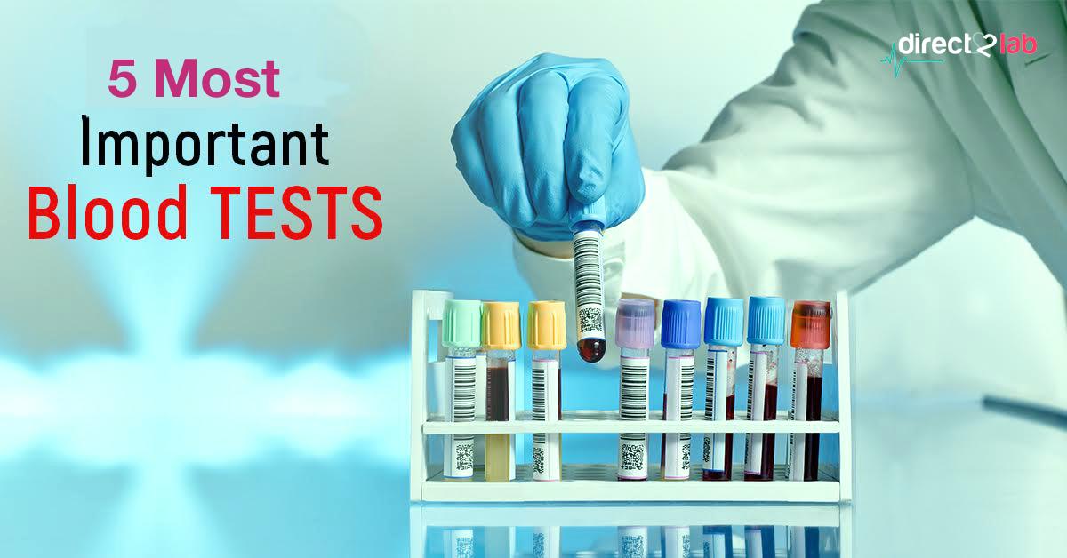 direct2lab.in/2019/05/14/5-e…