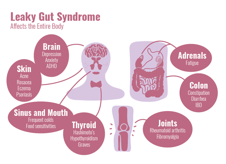 While we are #fasting, the microbes in our microbiome get time off from doing their digestive business to work on repairing the gastrointestinal tract, potentially offering protection from ‘leaky gut’ & the kind of systemic inflammation that can trigger chronic disease. #health