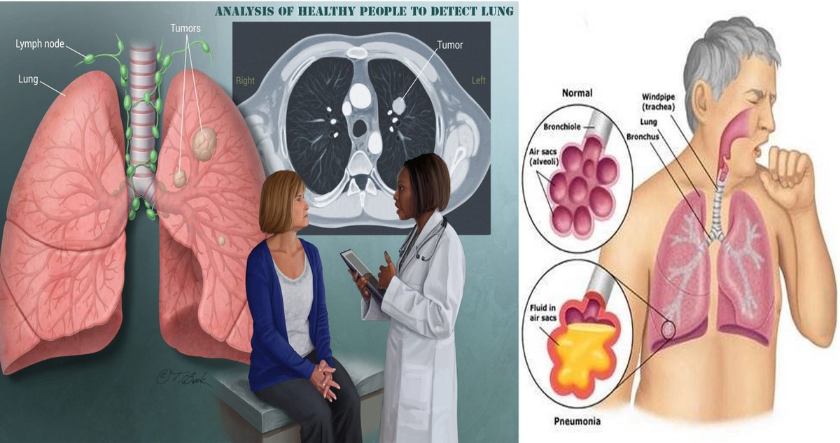 Analysis of healthy people to detect lung cancer
over-the-counterdrug.net/analysis-of-he…
  Oncologists,
  Pathologists,
  Pulmonologists,
  Radiation Oncology,
  Radiologists,
  Thoracic Surgeons,
  diagnose lung cancer,
  Sputum cytology,
  A tissue sample,
  the health care team,
  Surgery,