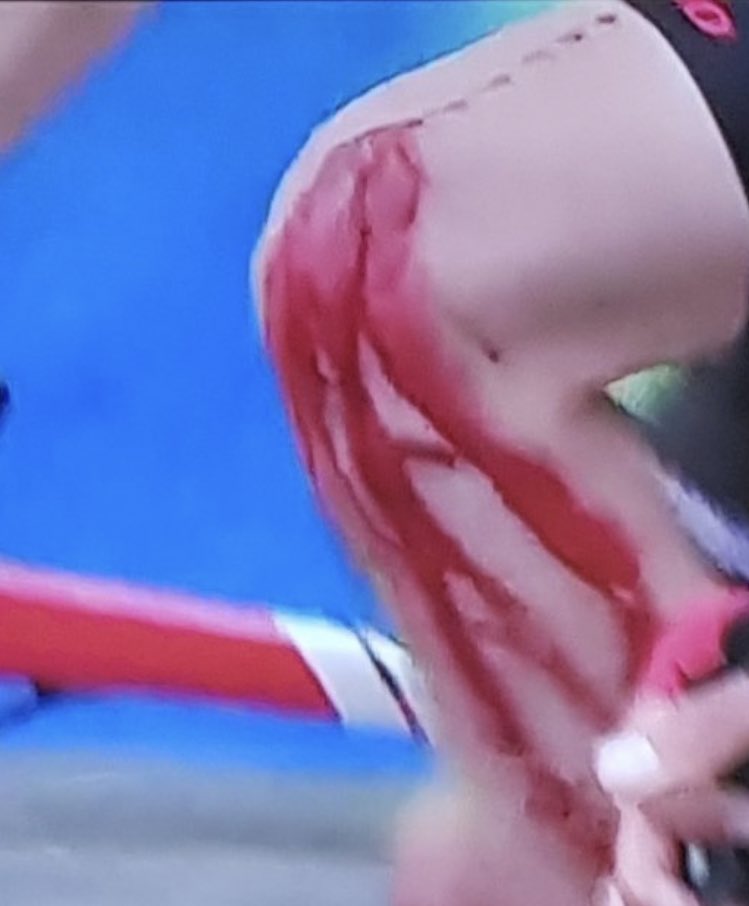 Au au au... da’s een heel tandwiel in z’n knie. #Dumoulin