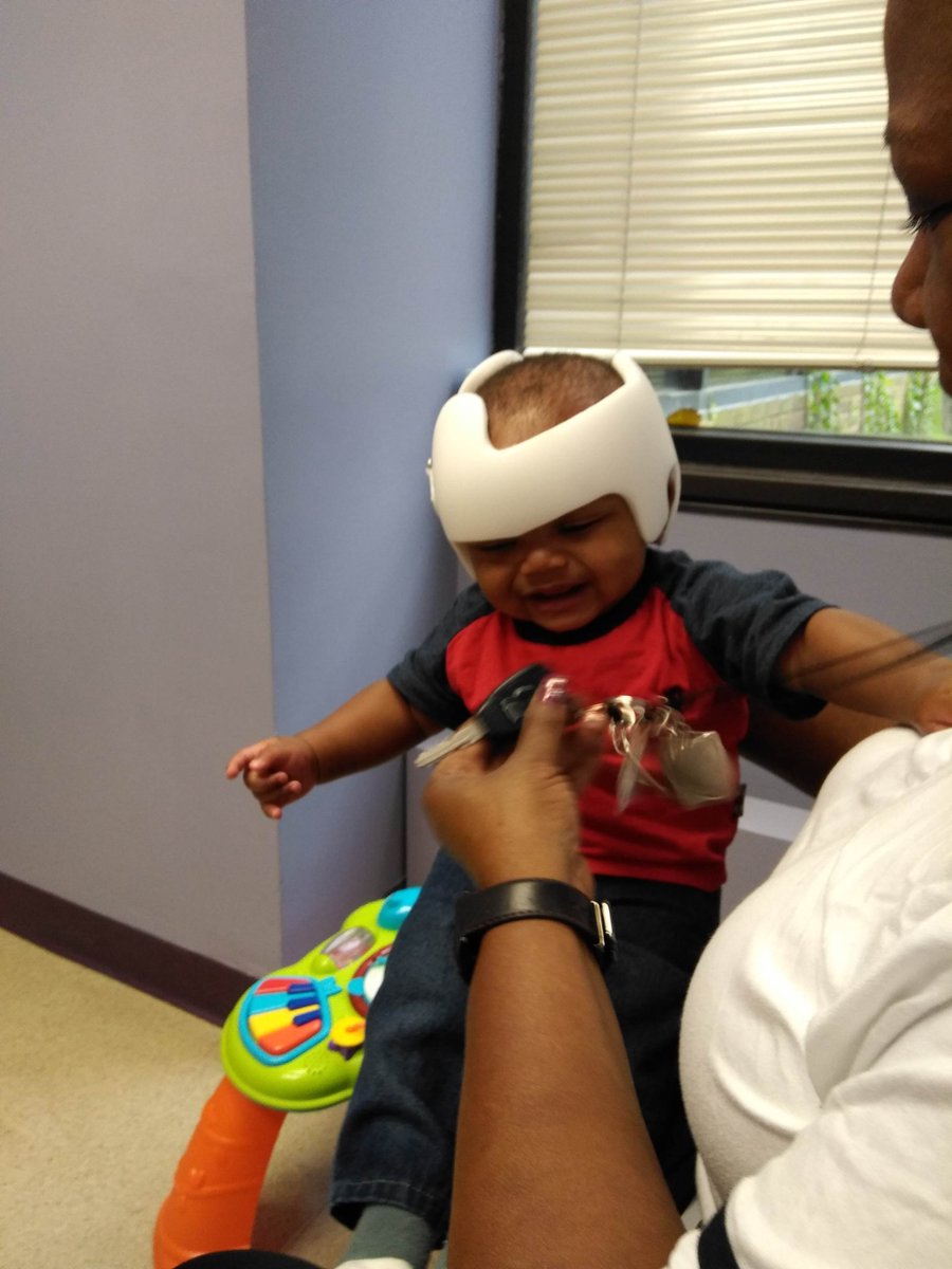 JuliaButterfly's tweet photo. Norei was born prematurely with plagiocephaly, a common condition in babies resulting in an abnormal head shape. Norei required a helmet that wasn't covered by insurance, so Julia's Butterfly Foundation funded the custom-made helmet. https://t.co/lGafbAUBwX