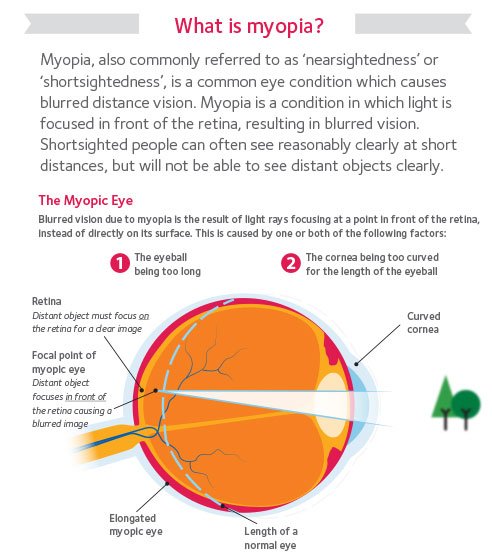 CooperVisionANZ's tweet photo. Today is Child Myopia Day, a CooperVisionANZ initiative to provide a platform for  ppl working within the eye care industry to share information around #childmyopia; why it needs our attention &amp; the opportunity to talk about the issue #ChildMyopiaDay https://t.co/qZNO6S1pk2
@WHO https://t.co/japYM3qRJm