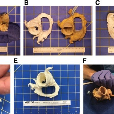 3dheals's tweet image. 3D printed medical models: There is a growing need for quality assurance in production @UWMedicine #3dprinting #medicalmodels #qualityassurance #DICOM #verification #technology #innovation #JointheTribe buff.ly/2D2H3XV bit.ly/2E7Hy3y