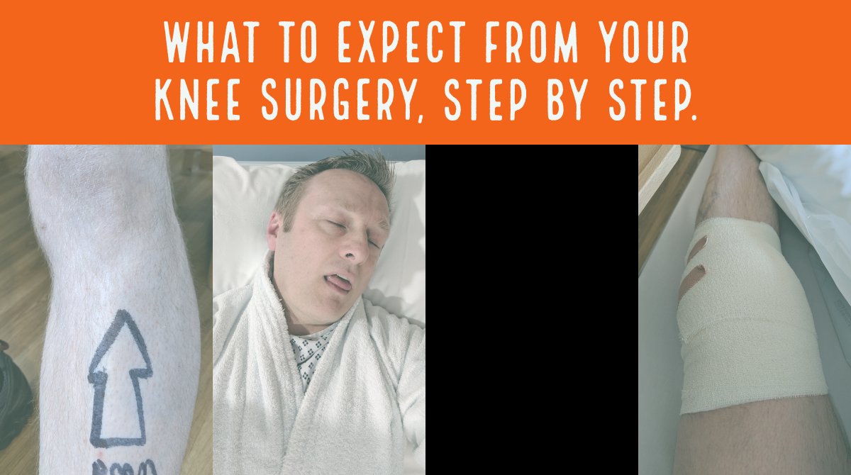 Ben_Hawkes's tweet image. Had spot of knee surgery yesterday, carried out by the excellent @petegallacher. For anyone else who might be getting similar surgery, I made this handy guide.