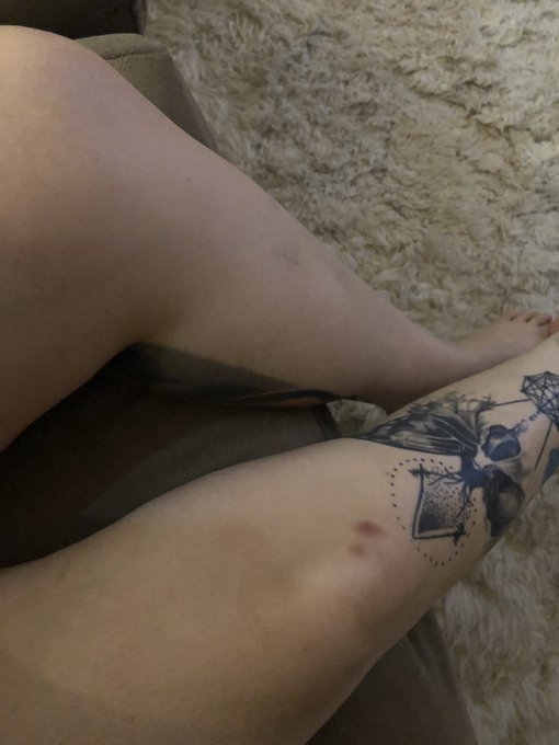 lucas deixando meu corpo todo roxo desde sempre ahuahauaha https://t.co/2O7Zn5f1Zk