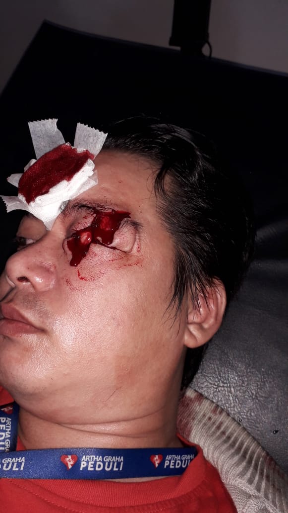 stay safe everyone!

semalem gegara gerombolan ini, temen bokap gue kena bacok pas lagi piket malem kantor di cabang daerah citayem.

orang kaya gini yang bikin negara berkembang ga bisa jadi negara maju.