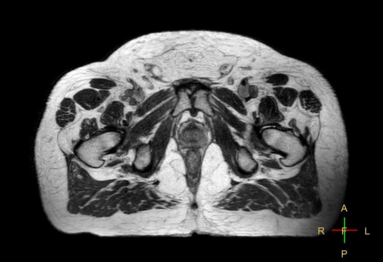 🧲MRIgRT Course  21 - 22 October 2019

Theory and practical sessions for all radiotherapy professionals including:
&gt; Basic principles of MRI 
&gt; MR Simulation
&gt; Adaptive radiotherapy on MR Linac

👉 Find out more and register bit.ly/2VELXFR