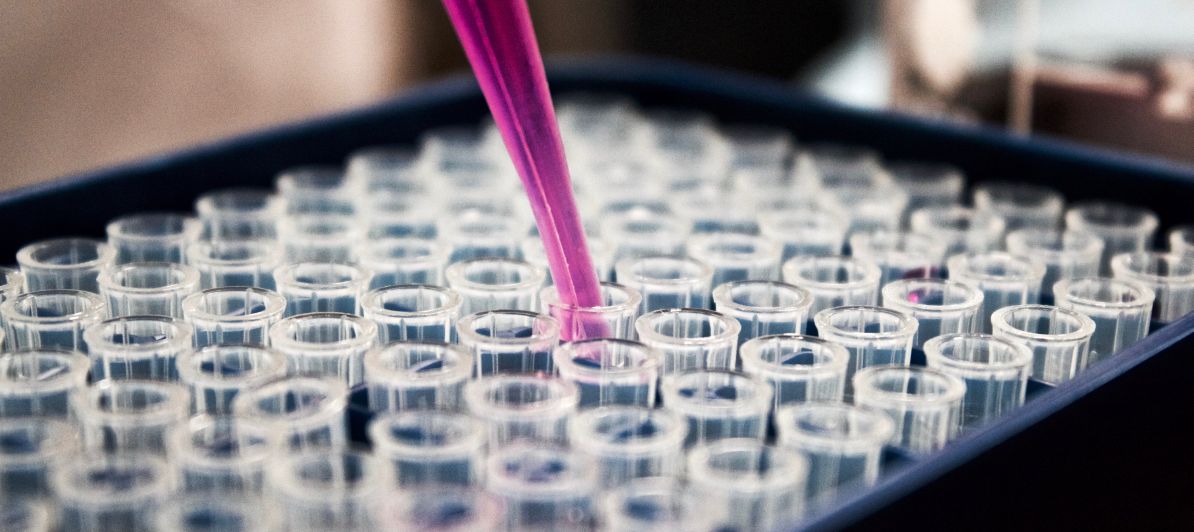 startuptickerCH's tweet photo. Basel based #INOFEA has spined-off Perseo Pharma to further develop therapeutic enzymes https://t.co/jTTCK1tVwi | The Swiss Startup News channel https://t.co/zlfBFXabB4 https://t.co/SOhEjtN8Kj