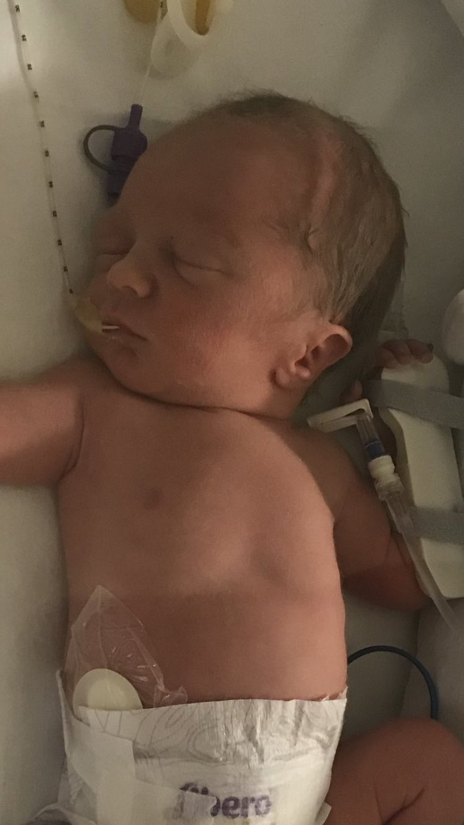 Jason Mossop tweet media