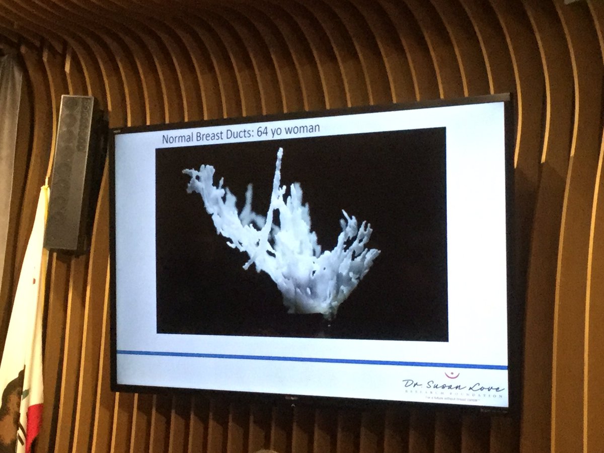 CABreastCancer's tweet photo. 3D model of human breast ducts #DLSRF mapping connections. @DrSusanLove #ToPreventBreastCancer https://t.co/v7taL8M2D0