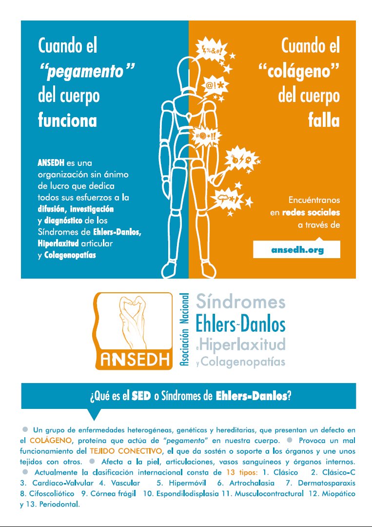 _TonOrtiz's tweet photo. Hoy 15 de Mayo, día mundial de la concientización del Síndrome de Ehlers-Danlos.
#SED #SEDDay #EhlersDanlosSyndrome #EhlersDanlos https://t.co/FEG3vsJoi5
