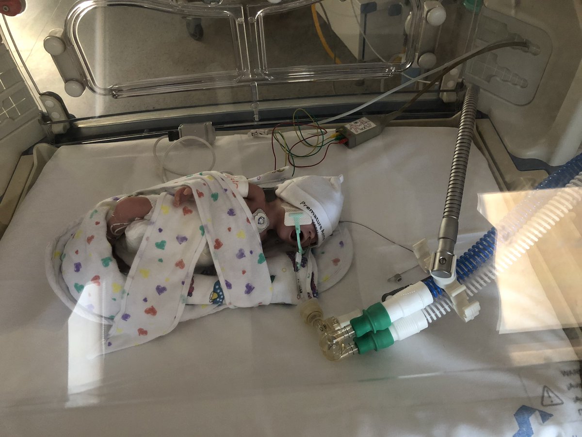 neonatoshusl's tweet photo. Evaluación de competencias adquiridas en la rotación de UCI neonatal mediante simulación clínica en nuestra Unidad. https://t.co/dKHdvWITLx