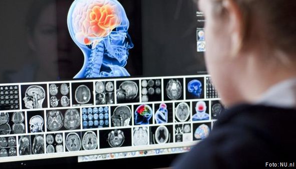 ‘Tijdverlies is hersenverlies bij een beroerte,’ vertelt Isala neuroloog Heleen den Hertog. Meer weten? Lees het interview met Heleen: nu.nl/gezondheid/588… #beroerte #tijdverliesishersenverlies