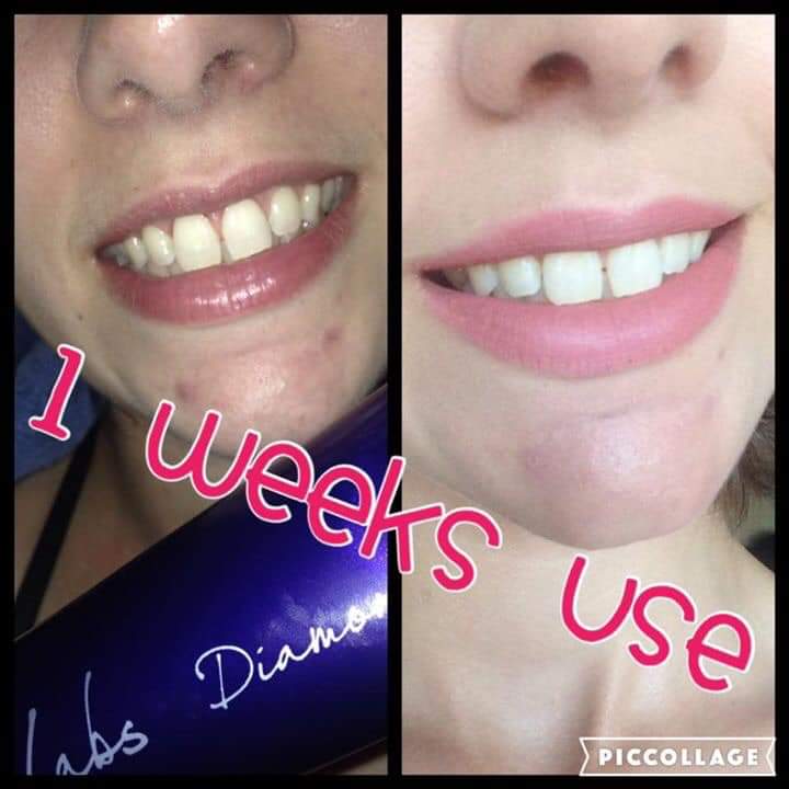 #whitening #toothpast #parabenfree #natural #ingerdients #Healthymouth #Healthygums #Healthyteeth this is one to #try #actilabs #actilife #tick #Vip for a #discount off your #entire #first #order #ecofriendly #careforyourteeth #smilebright acti-labs.com/me/melissa-dre…