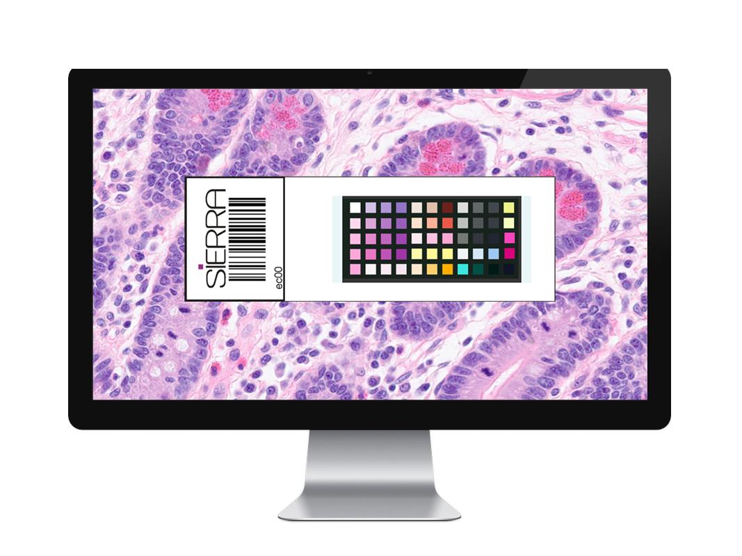 Richard Salmon, Life Science product Manager at FFEI, will be a guest speaker at the forthcoming Nordic Symposium on Digital Pathology. Richard will present on the topic of Color Management in Digital Pathology. linkedin.com/company/ffei/