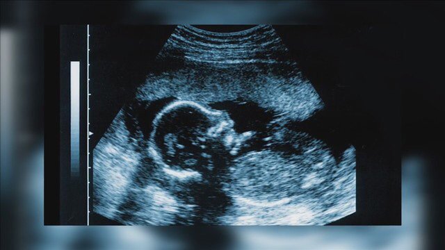 pastorjgkell's tweet photo. Abortion is a woman’s issue, but it is not only a woman’s issue.

A baby in a woman’s womb has a father and that father has responsibility.

Years ago I abdicated my responsibility and participated in an abortion.

It Wasn’t My Body But it was My Baby

https://t.co/pDOpmLf1Cg https://t.co/qHBHFzuOQV