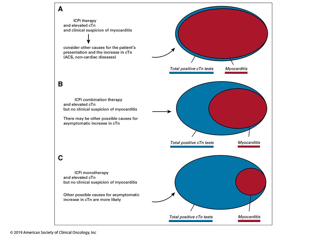 Measuring troponin for detection of immune checkpoint inhibitor-related myocarditis bit.ly/2Q238Lk #cardioonc #immunoonc