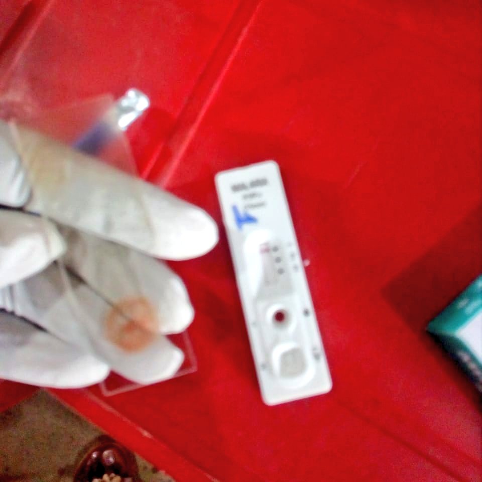 #Esmeraldas | Para determinar, predecir y proyectar factores de riesgo de enfermedades vectoriales, en la isla Luis Vargas Torres se realiza cerco epidemiológico, captación de pacientes febriles y toma de gota gruesa para exámen microscópico de paludismo, #SaludParaEsmeraldas