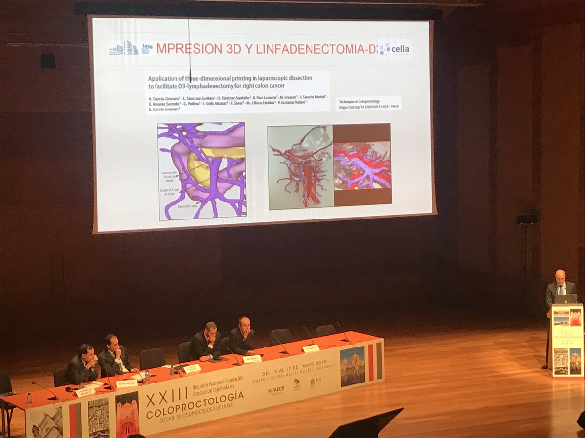 3D imaging reconstruction and AI in colorectal surgery: is the future already here? #rnaecp2019 <a href="/AECP_FAECP/">AECP</a> <a href="/cirdig_lafe/">Cir Digestiva La Fe</a>
