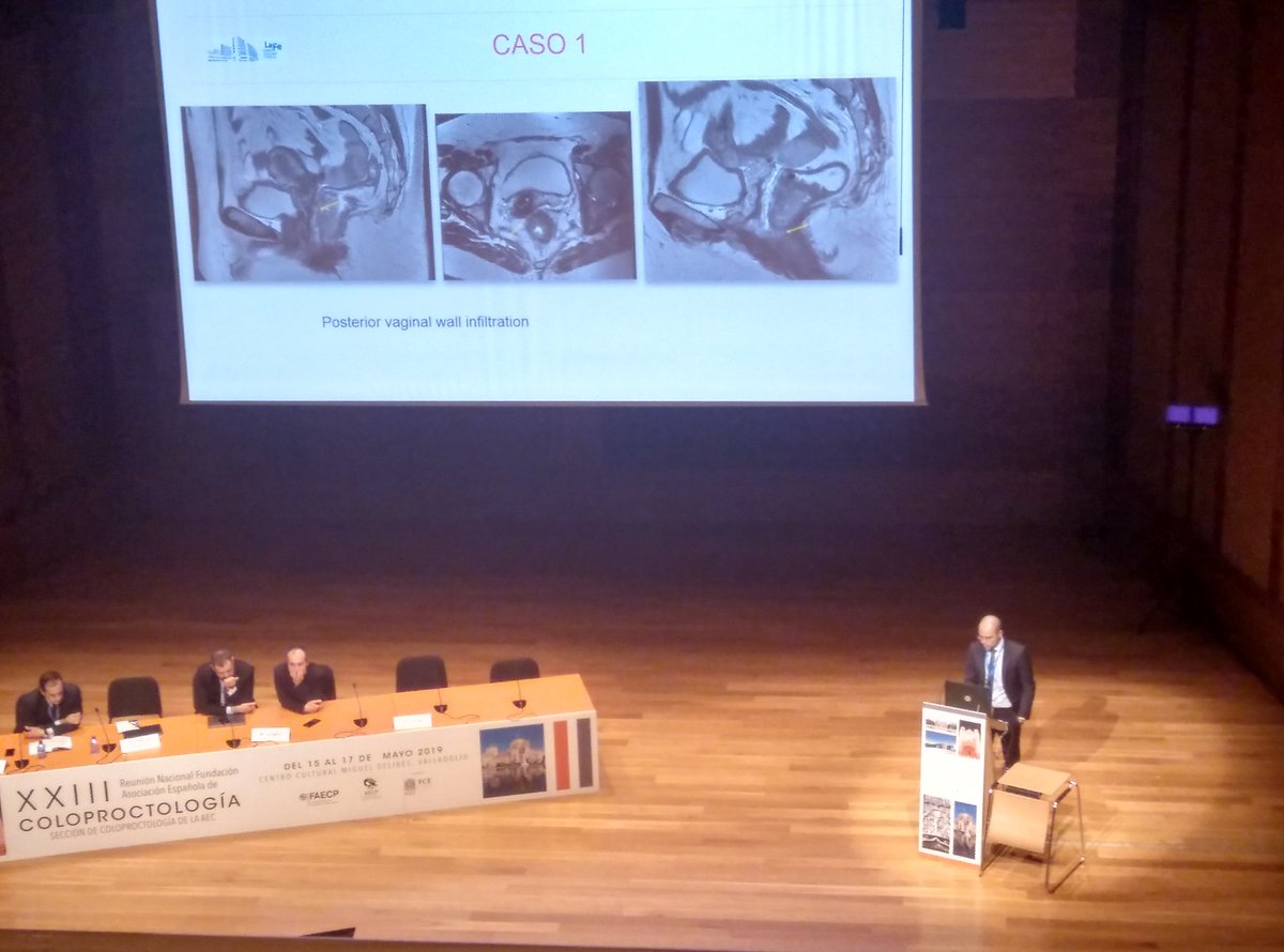 Novedosa presentació del Dr. Álvaro García-Granero. 3D
<a href="/cirdig_lafe/">Cir Digestiva La Fe</a> 
#rnaecp2019
