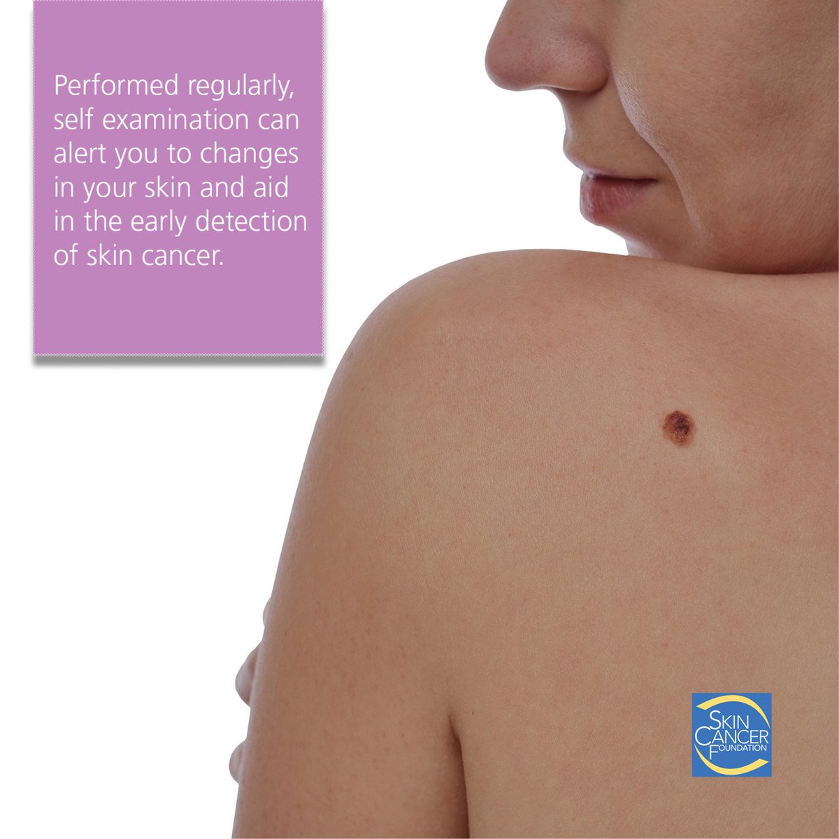 SkinCancerOrg's tweet photo. The Skin Cancer Foundation recommends that you do a head-to-toe self-examination of your skin every month, so you can find any new or changing lesions that might be cancerous or precancerous.  https://t.co/1UfYayTZ4p https://t.co/gdP8SPyB8k