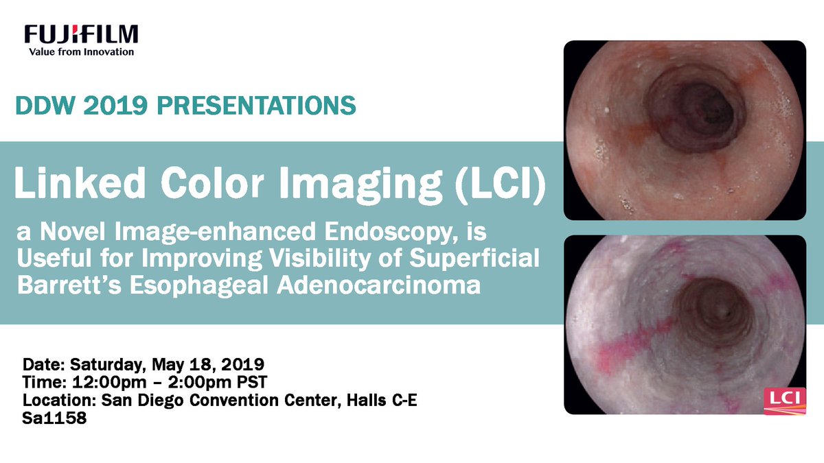 FujifilmHealth's tweet photo. Fujifilm’s endoscopy products will be featured in more than a dozen presentations in a few days at #DDW19! Check below for details, and be sure to work them into your agenda at the meeting. You won’t want miss #BLI, #LCI and our #ClutchCutter for #ESD. Fujifilm booth #4823 https://t.co/olOZ3EHoSH