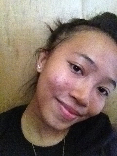 MaeFronda1's tweet photo. Pimples😢
#aintpretty https://t.co/PZVRKy37qs