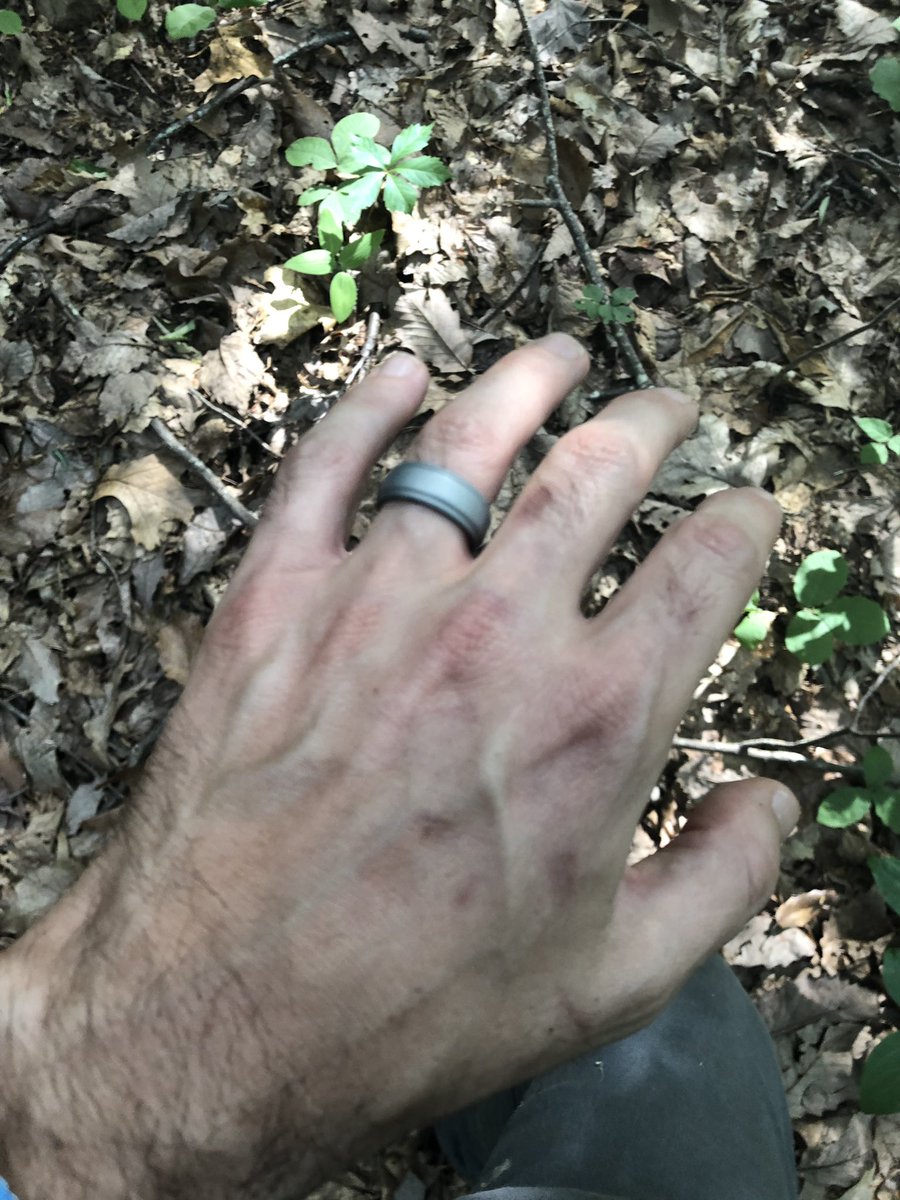 FatwoodBeard's tweet photo. Application rejected. Guess I’ll never be a silicone ring ambassador. How crushed were you when you found out you’d never become a hand model? #scarstellstories #15followers #whowillbe #numbersixteen https://t.co/l2Vd0RBUTQ