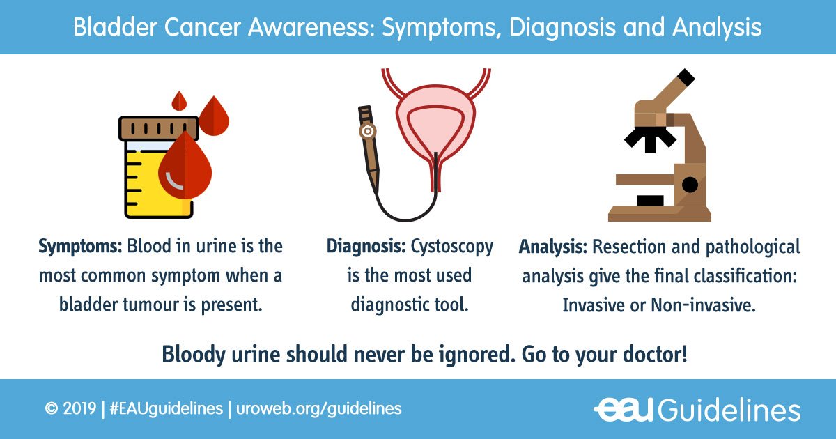 Blood in urine is the most common symptom when a bladder tumour is present. 
👉 It should never be ignored. Go to your doctor!

👨‍⚕️ Follow the guidelines on Bladder Cancer:
 uroweb.org/individual-gui…

#bladdercancerawarenessmonth #bladdercancer