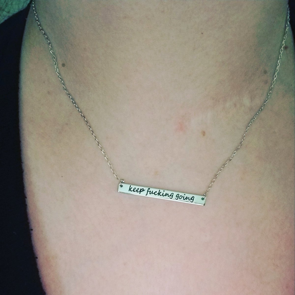 screamqueendaff's tweet image. So tell me Gentlemen... Are scars sexy? The metal plate and 4 screws between my C4 &amp;amp; C5 begs to differ...
#KeepFuckingGoing
#YouAreNotAlone