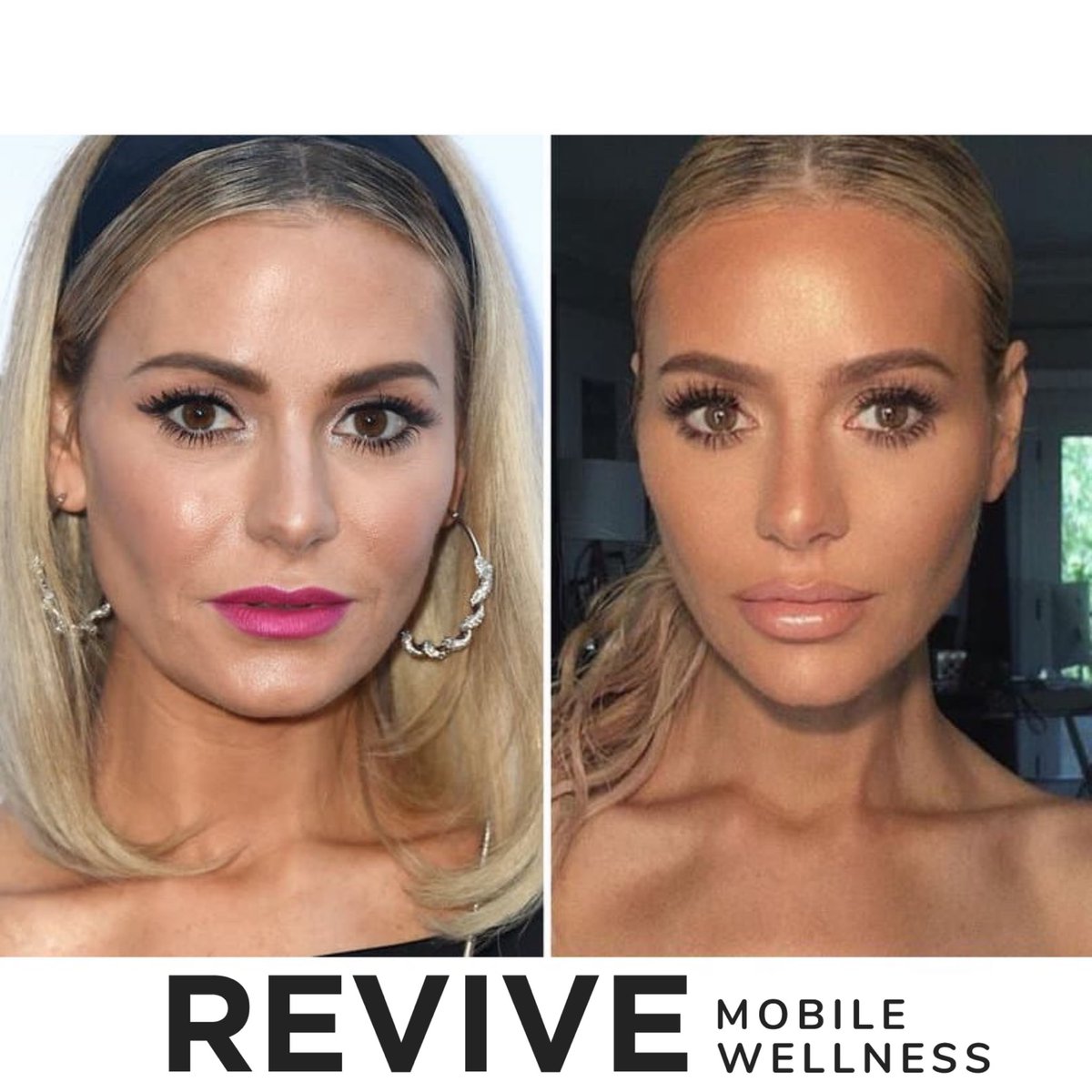 ReviveMobile's tweet image. Can we just have a moment for @doritkemsley new face!?What🙊The🙉What🙈
I’ll take two of whatever she’s having, please!
•
•
•
•
#transformationthursday #newfacewhodis #dallaslips #dallasbeautyblogger #glowup #juvederm 
#revivemobilewellness #botox  #dfwbeautyguide 
#rhobh