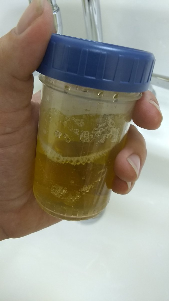 Avery_Love508's tweet photo. Don't forget to get tested when you catch some new meat 😉 you can't serve me if you're sick 😘 
#findom #cashmaster #tribute #staysafe #GetTested #peecup #piss #fagdom #fagtax https://t.co/1CC1RJ9OW3