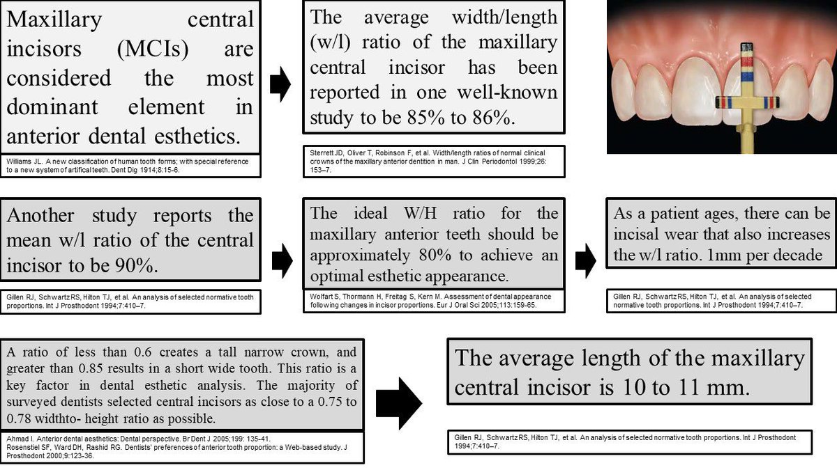 AbdullahAlshoai's tweet photo. #Restorative
#Esthetic
#Smile_Analysis
Central incisor W/L ratio.
What you think the best ratio? https://t.co/88dizSfDtd