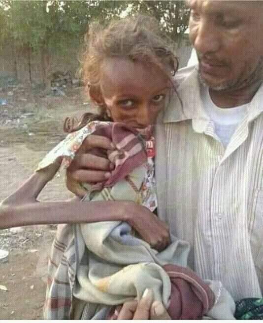 Nangbenji's tweet photo. Before our very own eyes. This is in Yemen and they have been heavily stricken by famine for more than four years now. We cannot turn a blind eye to their sufferings. https://t.co/iIpGBiS2Iv