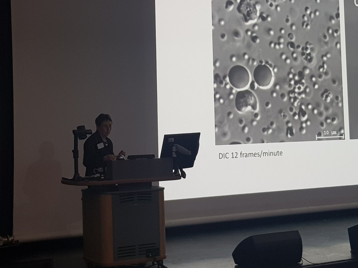 rli22's tweet photo. Fantastic talk now from my friend and #EM #legend #HelenSaibil about #egress (no, it's not a baby girl eagle) in #malaria #infection when the huddle of newly replicated virus particles busts out of the #redbloodcell #tomography #schizonts #merezoite https://t.co/tksPw8VzcF