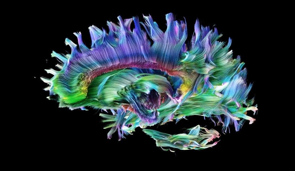 cardiffuni's tweet photo. “Your existence, your personality, everything you do, everything you think, everything you’ve done—it’s all there in that few litres of stuff.”

Prof @Dee_Kay_Jay @CUBRICcardiff discusses the beauty of your brain &amp; how to see it https://t.co/766Y28k80e

#MentalHealthAwarenessWeek https://t.co/sdOQEkO9gs
