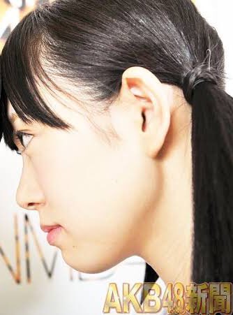 のりしお みるきー抜歯矯正を始めて口ゴボが治って綺麗なeラインが出来始めてるのいいな 元々可愛かったけど口元が整ってきて 更に可愛くなったしとっても綺麗 すき T Co Nwxx5p9yhy Twitter