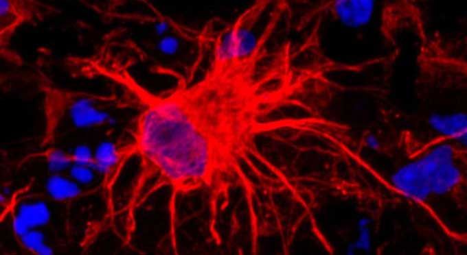 sciencebeta's tweet image. Multidisciplinary Study Looks At Effects Of Environmental Factors On Astrocytes bit.ly/2U56ga3 #pesticides