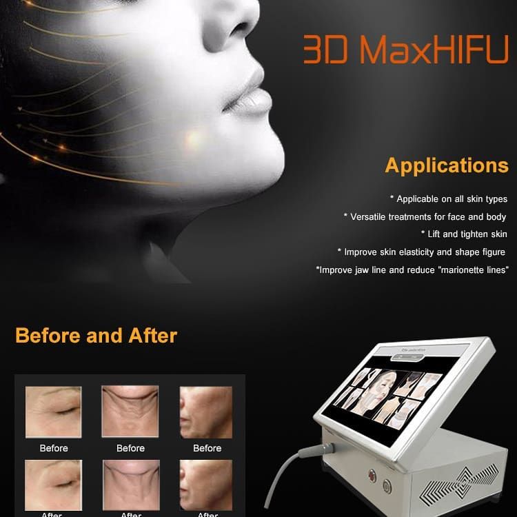 AdyYou2's tweet photo. Non surgical #Hifutreatment #facelift #skintightening #Skincare #plasticsurgery #dermatology #clinic #doctor #Skin #SPA #salon #aesthetics #beauty 
Kindly contact for more info.
medical@sincoheren.com https://t.co/uOVB8KAbL0